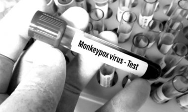 El último brote de viruela del mono es el resultado de un virus manipulado por Biolab