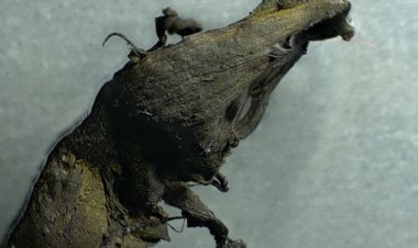 BOMBAZO - Impactantes fotos microscopía de coágulos de sangre vacunados COVID 19