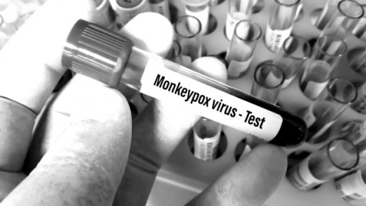 El último brote de viruela del mono es el resultado de un virus manipulado por Biolab