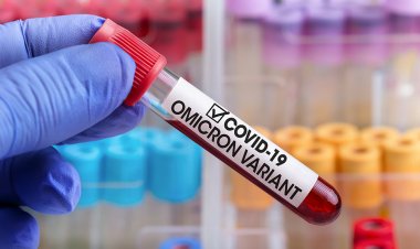 Ciudadanos "positivos" de Covid en Hong Kong obligados a usar rastreadores de pulseras de tobillo como delincuentes