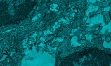 Vacunas Covid: 2 muestras analizadas no contienen 'elementos de vida'