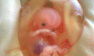 California centro del aborto