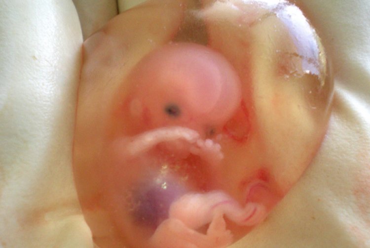 California centro del aborto