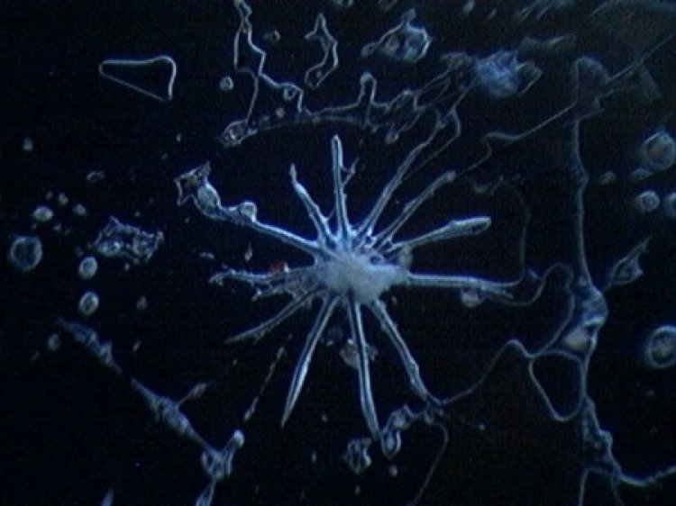 Chemtrails Y Morgellons