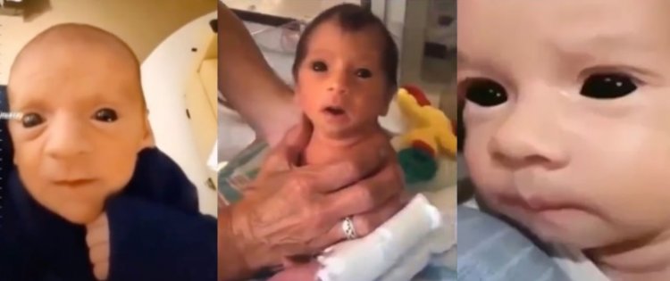 Los bebés de ojos negros están naciendo de padres vacunados