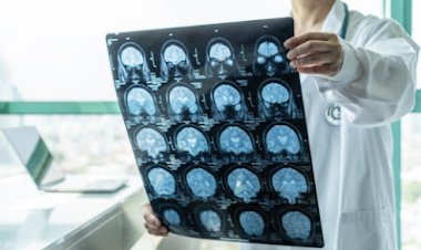 Daños al corazón y al cerebro tras la inoculación COVID 19