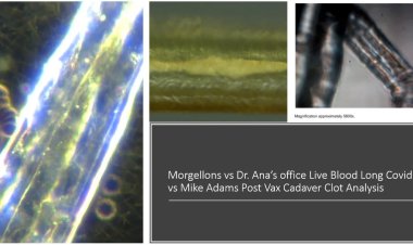 Formas de vida biológicas sintéticas