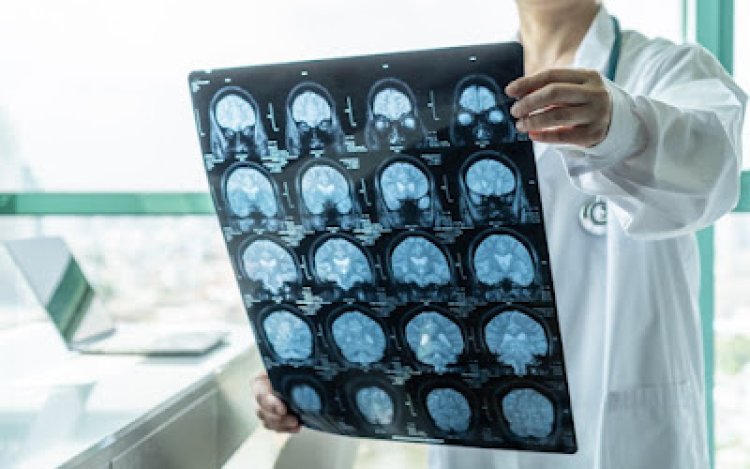 Daños al corazón y al cerebro tras la inoculación COVID 19