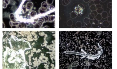Científicos piden el fin de las "vacunas" contra el covid-19