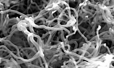 Riesgo de cáncer por nanotubos de carbono