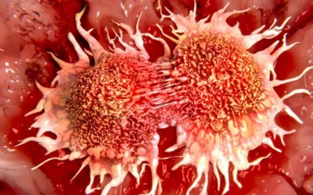 Aumentan los casos de cáncer