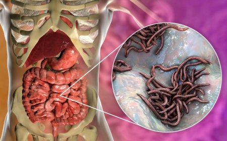 Todos tenemos parásitos