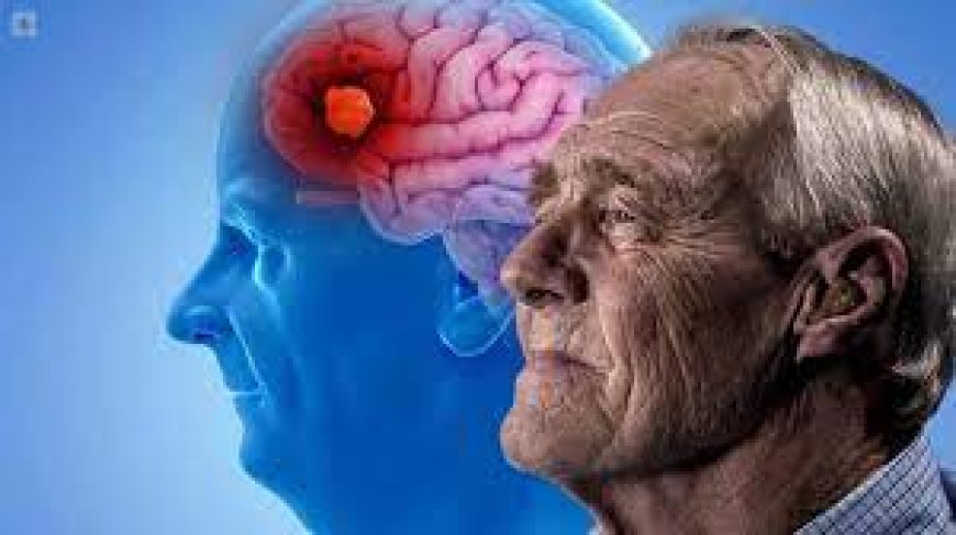 La enfermedad de Alzheimer se propagó a través de tratamientos que están prohibidos hoy en día