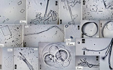 Mas confirmacion sobre nanoestructuras en vacunas