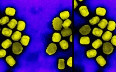 Los PCR no pueden diagnosticar las infecciones por viruela símica