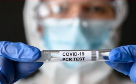 Las pruebas PCR no funcionan