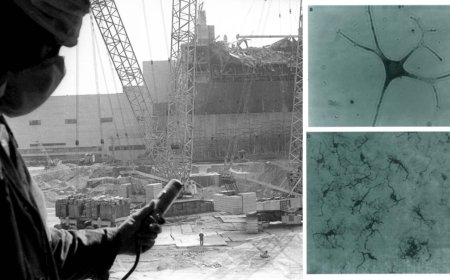 El desastre de Chernobyl propició uno de los mayores avances médicos