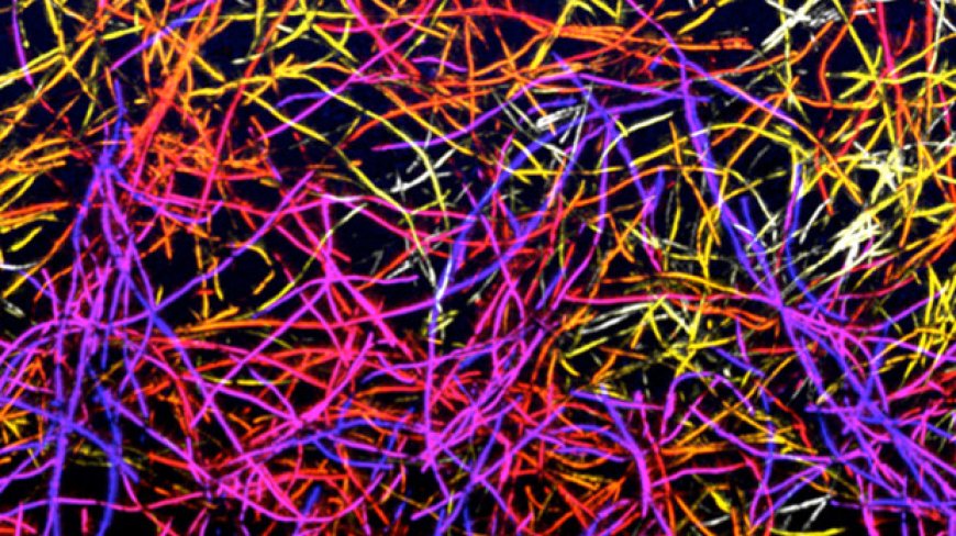 Fibras extrañas en nuestros cuerpos, nanotubos y otros inventos diabólicos para destruir a la humanidad