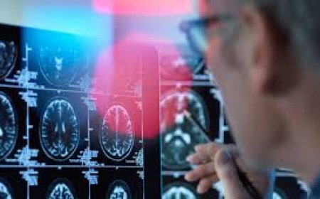 Demencia se puede curar aunque no lo reconocen