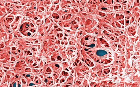 La enfermedad de Lyme