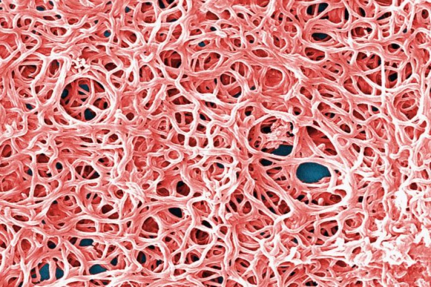 La enfermedad de Lyme