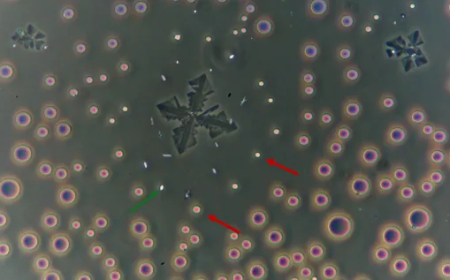 Ensamblaje sintético en la anestesia dental