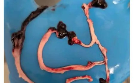 Coágulos rde sangre encontrados en hijos de madres vacunadas COVID-19