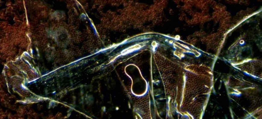 Nanoestructuras autoensambladas en sangre y orina
