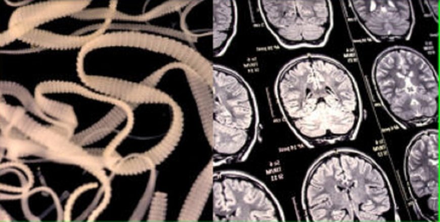 Gusanos en el cerebro de los vacunados COVID 19