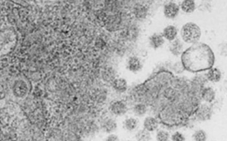 Más GRAFENO...Siguen con la operación PREHIBRIDACIÓN