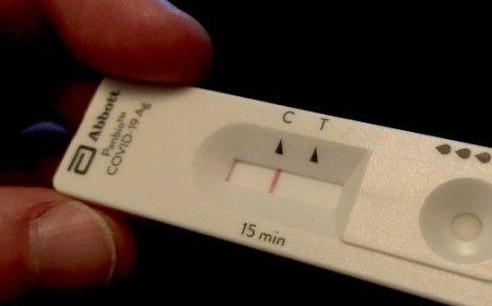 La verdad de las PCR usados en la Plandemia