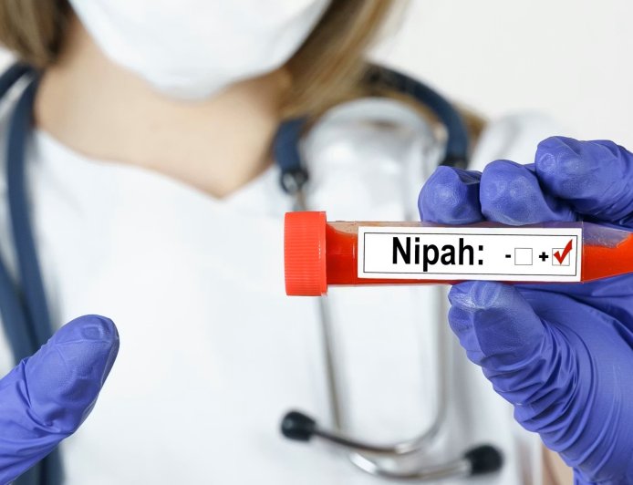 NIPAH, el falso virus que han inventado