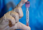 El genoma del hantavirus se construyó a partir de 'sangre humana' en el Bioloab militar estadounidense