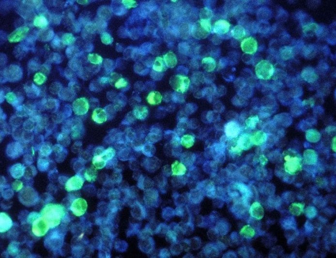 No hay material biológico en esas mal llamadas vacunas