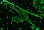 Informe Vacunas COVID 19 a microscopía de fluorescencia