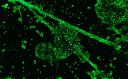 Informe Vacunas COVID 19 a microscopía de fluorescencia