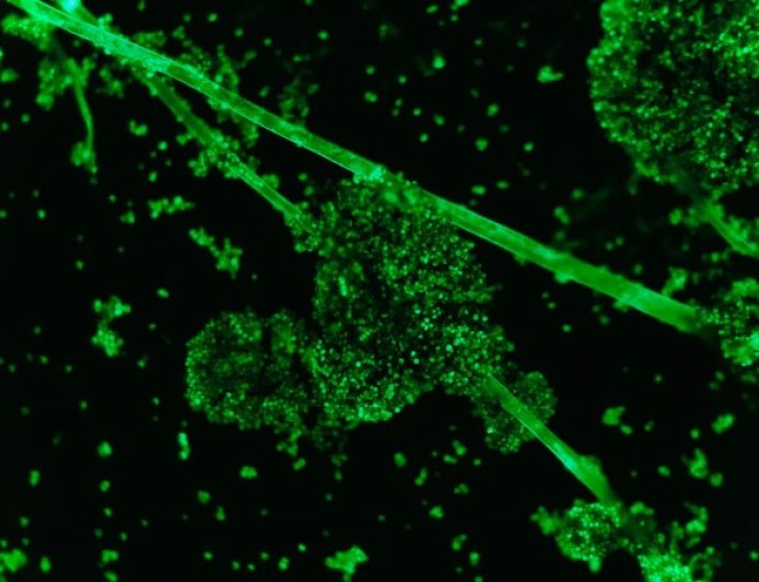 Informe Vacunas COVID 19 a microscopía de fluorescencia
