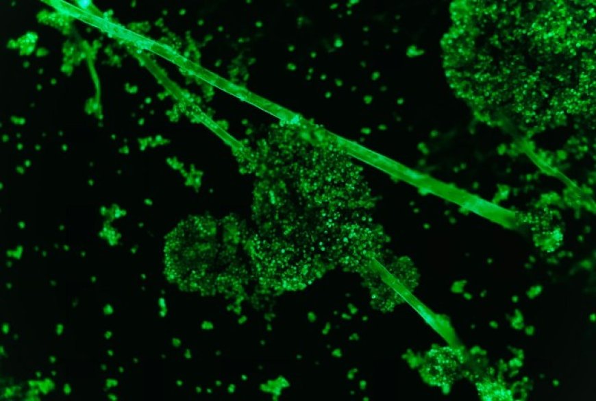 Informe Vacunas COVID 19 a microscopía de fluorescencia